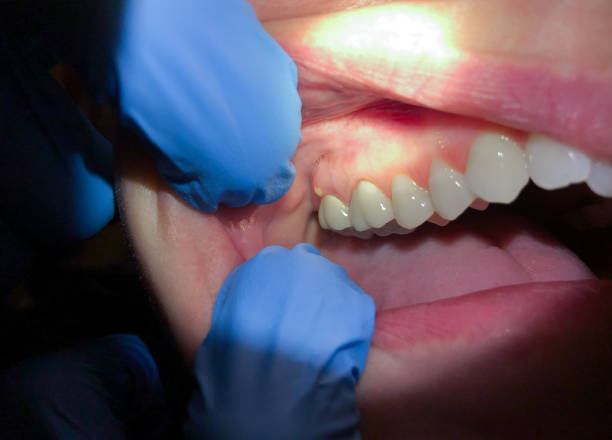 Best Urgent Tooth Repair  in Red Bay, AL